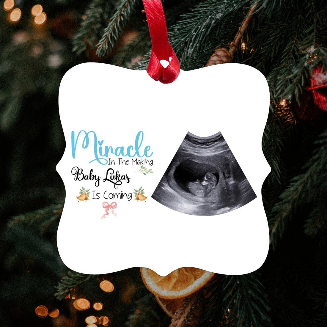 Miracle In The Making Baby Is Coming - Personalized Christmas Pregnancy Announcement gift for Dad and Mom to Be - Custom Square Aluminum Ornament - Elizabeth Fashions